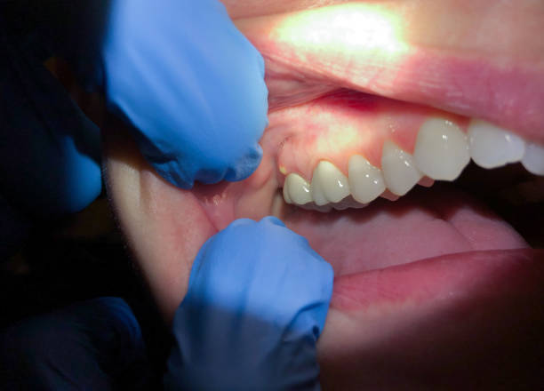 Best Emergency Pediatric Dental Care in Queensland, MD