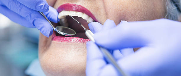 Best Emergency Dental Care for Sports Injuries in Queensland, MD